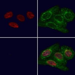 Invitrogen QKI Polyclonal Antibody 100 &mu;L; Unconjugated:Antibodies,
