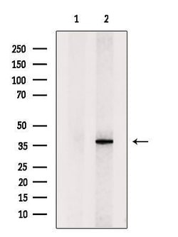 Invitrogen QKI Polyclonal Antibody 100 &mu;L; Unconjugated:Antibodies,