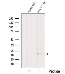 Invitrogen REEP1 Polyclonal Antibody 100 &mu;L; Unconjugated:Antibodies,