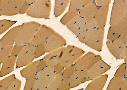 Invitrogen RIC8A Polyclonal Antibody 100 &mu;L | Buy Online | Invitrogen&trade; | Fisher Scientific