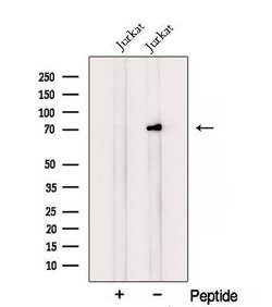 Invitrogen RNF12 Polyclonal Antibody 100 &mu;L; Unconjugated:Antibodies,