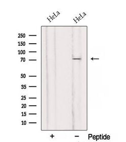 Invitrogen RMI1 Polyclonal Antibody 100 &mu;L; Unconjugated:Antibodies,
