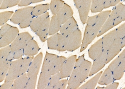 Invitrogen RNaseH2C Polyclonal Antibody 100 &mu;L; Unconjugated:Antibodies,