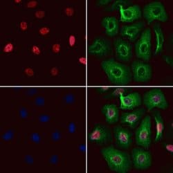 Invitrogen RNaseH2C Polyclonal Antibody 100 &mu;L; Unconjugated:Antibodies,