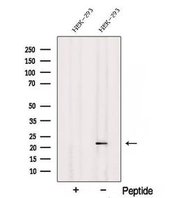 Invitrogen RNaseH2C Polyclonal Antibody 100 &mu;L; Unconjugated:Antibodies,