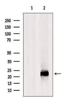Invitrogen RNaseH2C Polyclonal Antibody 100 &mu;L; Unconjugated:Antibodies,