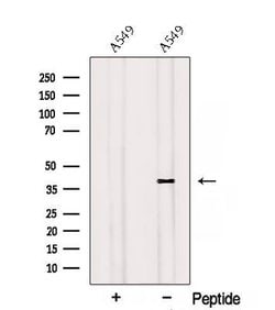 Invitrogen RSPO3 Polyclonal Antibody 100 &mu;L | Buy Online | Invitrogen&trade; | Fisher Scientific