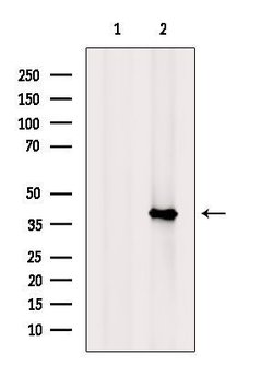 Invitrogen RSPO3 Polyclonal Antibody 100 &mu;L | Buy Online | Invitrogen&trade; | Fisher Scientific