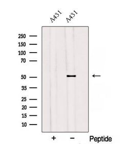 Invitrogen SAMM50 Polyclonal Antibody 100 &mu;L | Buy Online | Invitrogen&trade; | Fisher Scientific