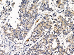 Invitrogen SCO2 Polyclonal Antibody 100 &mu;L; Unconjugated:Antibodies,