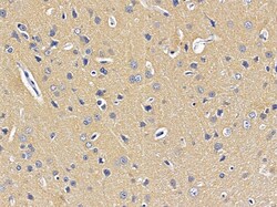 Invitrogen SCO2 Polyclonal Antibody 100 &mu;L; Unconjugated:Antibodies,