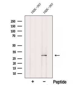 Invitrogen SCO2 Polyclonal Antibody 100 &mu;L; Unconjugated:Antibodies,