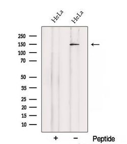 Invitrogen SETBP1 Polyclonal Antibody 100 &mu;L | Buy Online | Invitrogen&trade; | Fisher Scientific