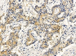 Invitrogen SGMS1 Polyclonal Antibody 100 &mu;L; Unconjugated:Antibodies,