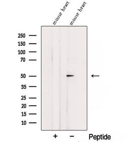 Invitrogen SGMS1 Polyclonal Antibody 100 &mu;L; Unconjugated:Antibodies,