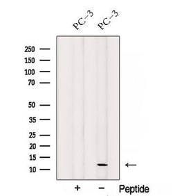Invitrogen SPCS1 Polyclonal Antibody 100 &mu;L | Buy Online | Invitrogen&trade; | Fisher Scientific