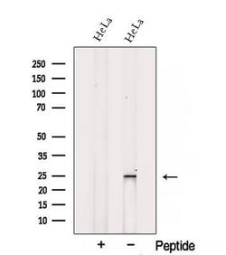Invitrogen SPRR3 Polyclonal Antibody 100 &mu;L; Unconjugated:Antibodies,
