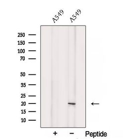 Invitrogen SRP19 Polyclonal Antibody 100 &mu;L; Unconjugated:Antibodies,