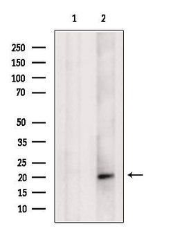 Invitrogen SRP19 Polyclonal Antibody 100 &mu;L; Unconjugated:Antibodies,