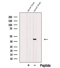 Invitrogen ST8SIA2 Polyclonal Antibody 100 &mu;L; Unconjugated:Antibodies,
