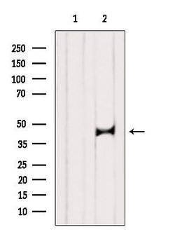 Invitrogen ST8SIA2 Polyclonal Antibody 100 &mu;L; Unconjugated:Antibodies,