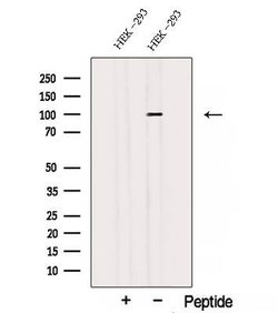 Invitrogen STT3A Polyclonal Antibody 100 &mu;L | Buy Online | Invitrogen&trade; | Fisher Scientific