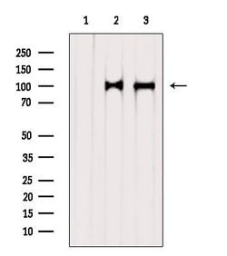 Invitrogen STT3A Polyclonal Antibody 100 &mu;L | Buy Online | Invitrogen&trade; | Fisher Scientific