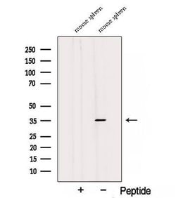 Invitrogen STX7 Polyclonal Antibody 100 &mu;L; Unconjugated:Antibodies,
