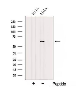 Invitrogen TBCE Polyclonal Antibody 100 &mu;L | Buy Online | Invitrogen&trade; | Fisher Scientific