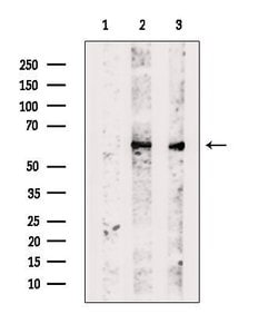Invitrogen TBCE Polyclonal Antibody 100 &mu;L | Buy Online | Invitrogen&trade; | Fisher Scientific