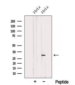 Invitrogen THAP2 Polyclonal Antibody 100 &mu;L | Buy Online | Invitrogen&trade; | Fisher Scientific