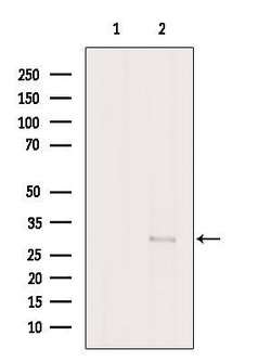 Invitrogen THAP2 Polyclonal Antibody 100 &mu;L | Buy Online | Invitrogen&trade; | Fisher Scientific
