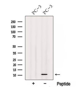 Invitrogen TIMM13 Polyclonal Antibody 100 &mu;L | Buy Online | Invitrogen&trade; | Fisher Scientific