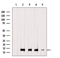 Invitrogen TIMM13 Polyclonal Antibody 100 &mu;L | Buy Online | Invitrogen&trade; | Fisher Scientific