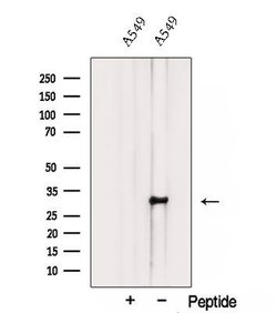 Invitrogen TMEM106B Polyclonal Antibody 100 &mu;L; Unconjugated:Antibodies,