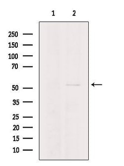 Invitrogen TRIM15 Polyclonal Antibody 100 &mu;L | Buy Online | Invitrogen&trade; | Fisher Scientific