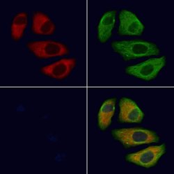 Invitrogen TRPC1 Polyclonal Antibody 100 &mu;L; Unconjugated:Antibodies,