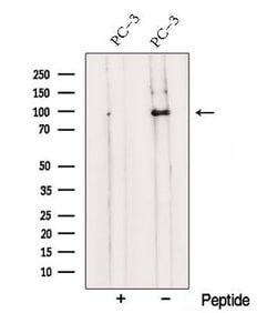 Invitrogen TRPC1 Polyclonal Antibody 100 &mu;L; Unconjugated:Antibodies,