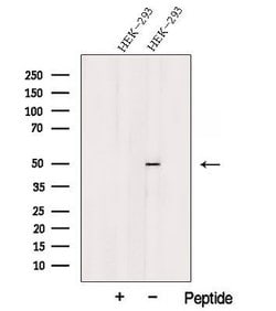 Invitrogen TSP50 Polyclonal Antibody 100 &mu;L; Unconjugated:Antibodies,