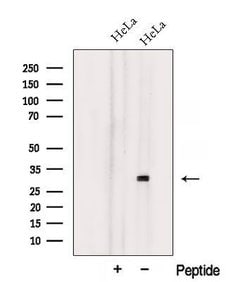 Invitrogen NXNL1 Polyclonal Antibody 100 &mu;L; Unconjugated:Antibodies,