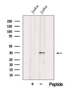 Invitrogen UCK2 Polyclonal Antibody 100 &mu;L; Unconjugated:Antibodies,