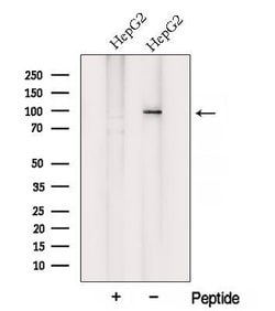 Invitrogen VPS35 Polyclonal Antibody 100 &mu;L; Unconjugated:Antibodies,