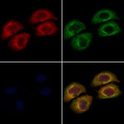 Invitrogen VPS41 Polyclonal Antibody 100 &mu;L | Buy Online | Invitrogen&trade; | Fisher Scientific