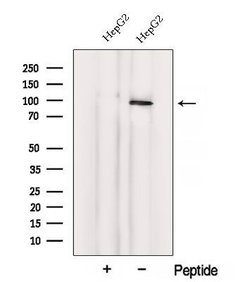 Invitrogen VPS41 Polyclonal Antibody 100 &mu;L | Buy Online | Invitrogen&trade; | Fisher Scientific