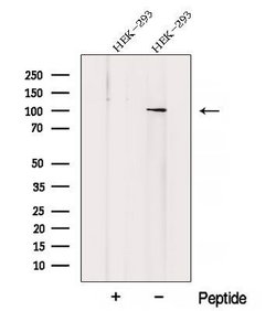 Invitrogen ZHX1 Polyclonal Antibody 100 &mu;L; Unconjugated:Antibodies,