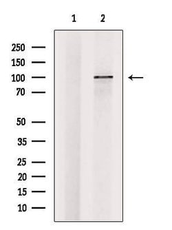 Invitrogen ZHX1 Polyclonal Antibody 100 &mu;L; Unconjugated:Antibodies,
