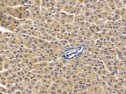 Invitrogen SOAT2 Polyclonal Antibody 100 &mu;L | Buy Online | Invitrogen&trade; | Fisher Scientific