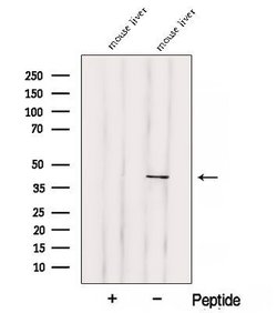 Invitrogen SOAT2 Polyclonal Antibody 100 &mu;L | Buy Online | Invitrogen&trade; | Fisher Scientific