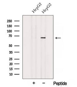 Invitrogen ACSM3 Polyclonal Antibody 100 &mu;L; Unconjugated:Antibodies,