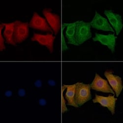Invitrogen Alcohol Dehydrogenase 1B Polyclonal Antibody 100 &mu;L; Unconjugated:Antibodies,